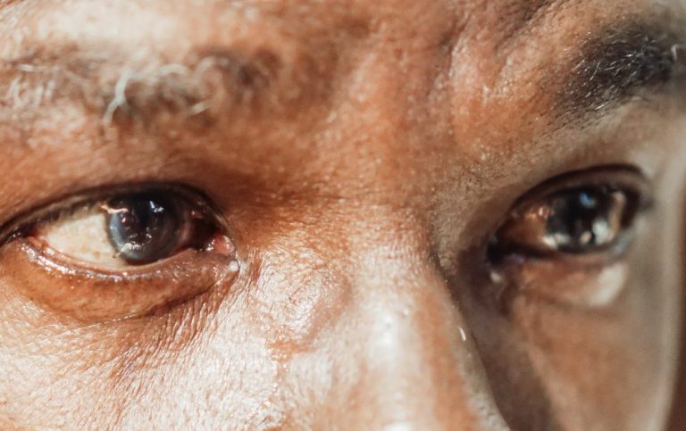 larmoiement des yeux, pourquoi mes yeux pleurent, larmes qui coulent seules